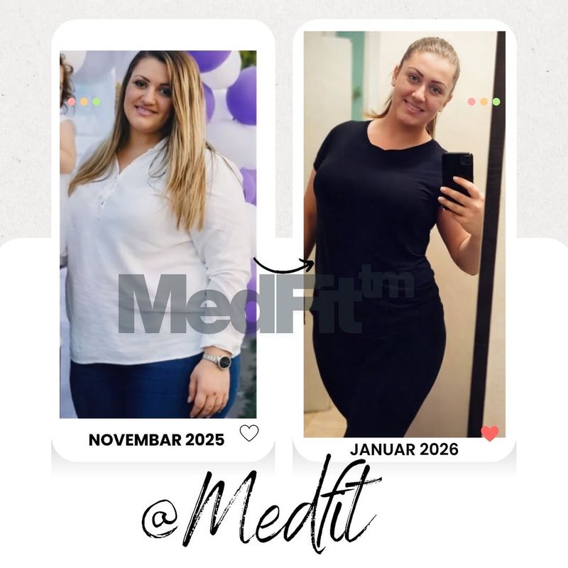 MedFit transformacija – rezultati kupice