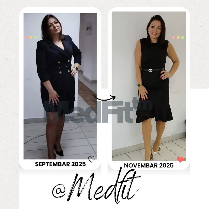 MedFit transformacija – rezultati kupice